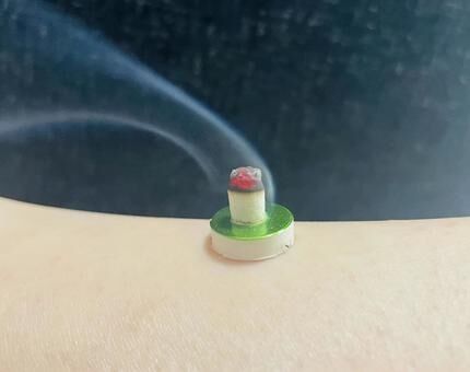 肌の上に置いたお灸から、煙が立ちのぼっている様子